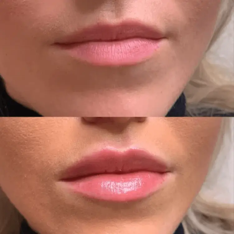 Close-up comparison of lips before and after makeup application, showing smoother, glossy lips in the second image.