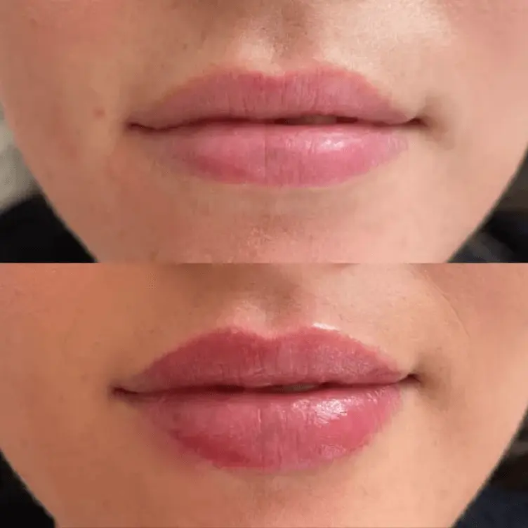 Close-up of a person's lips before and after applying lip makeup or gloss.