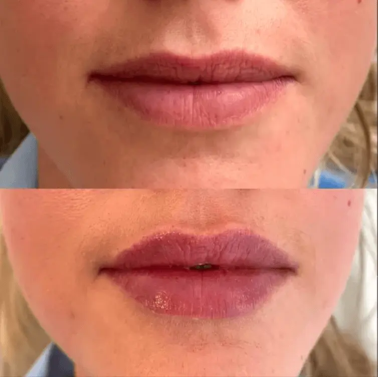 Close-up of a person's lips before and after applying lip makeup, showing natural and makeup-enhanced lips.